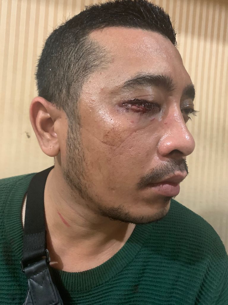 Kanit Reskrim Polsek Medan Baru Diduga Terima “Imbalan” Dari Tersangka Penganiayaan 