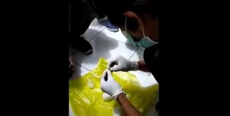Pria Ini Selundupkan 201 gram Sabu Dalam Anus
