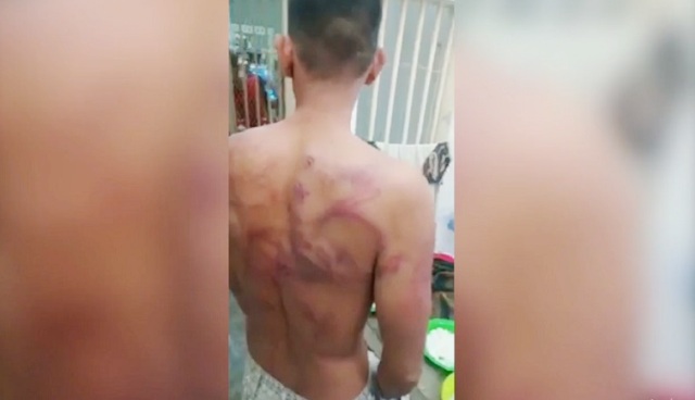 VIRAL! Warga Binaan Lapas Kelas 1 Tanjung Gusta Babak Belur, Diduga Dianiaya Sipir