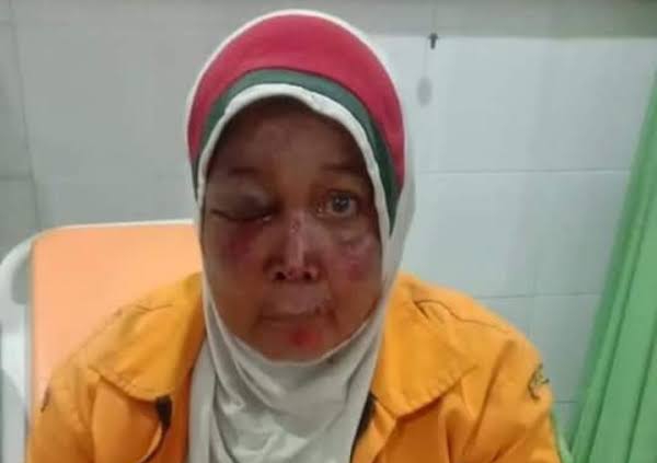 Begal di Medan Semakin Menggila, Wanita Paruh Baya Jadi Korban Begal