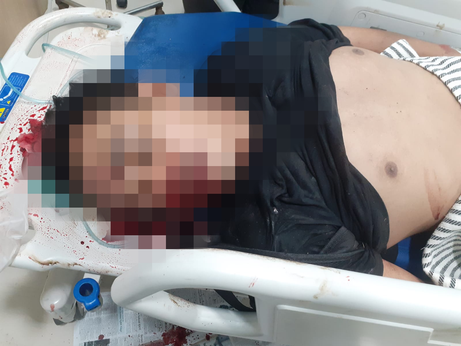 Diduga Korban Lakalantas, Penumpang Ojol Ditemukan Tewas