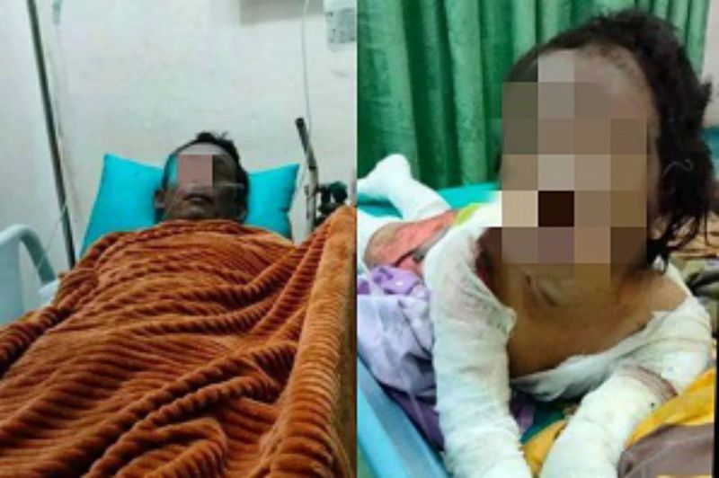 Tabung Gas Meledak di Tebing Tinggi, 3 Tewas, Satu Korban Berumur 7 Tahun