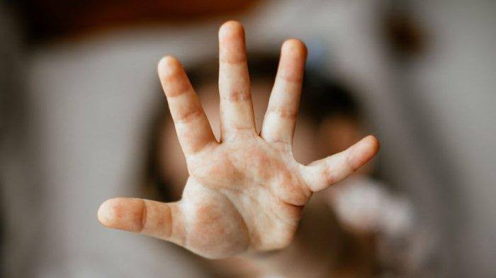 Di Polres Binjai Kasus Pencabulan Anak Dibawah Umur Jalan Ditempat