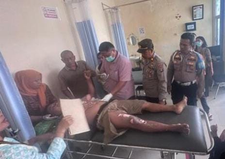 Seorang Tukang Bangunan Tersengat Arus Listrik ,Paha & Tangan Melepuh