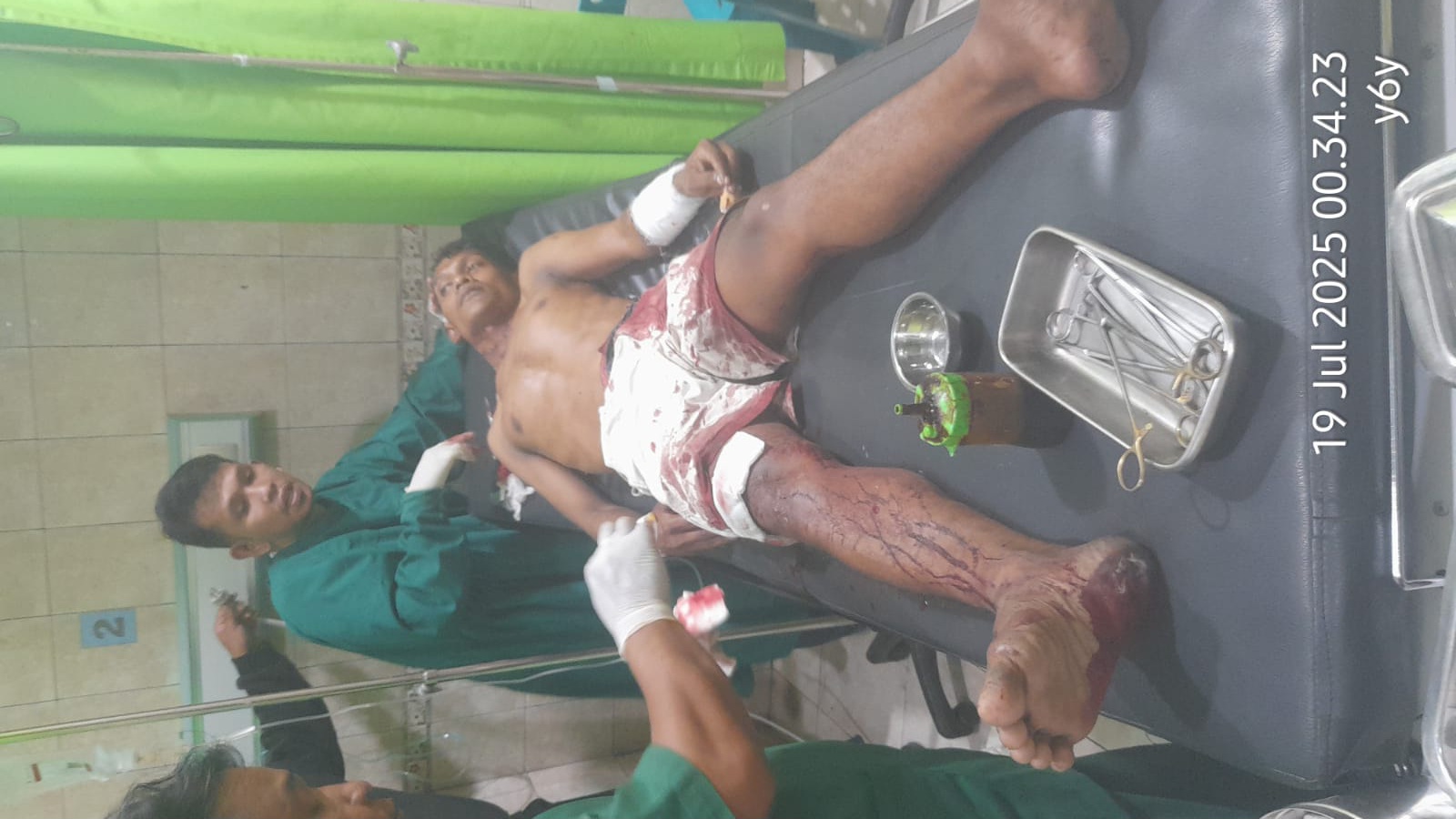 Gerombolan OTK Di Sei Bingai Serang Warga Secara Brutal