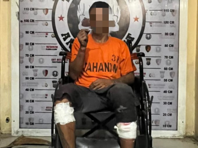 Gegara Melawan Saat Ditangkap, Kaki Curanmor Bolong Dipelor