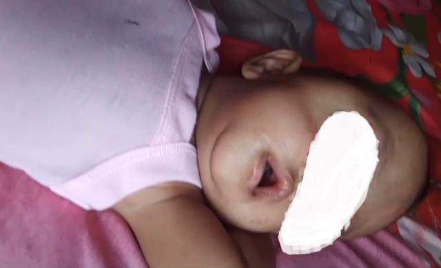 Pemkab beserta DPRD Madina menggalang donasi untuk pengobatan anak mengidap kanker mata yang dirawat di RS M Jamil Padang.
