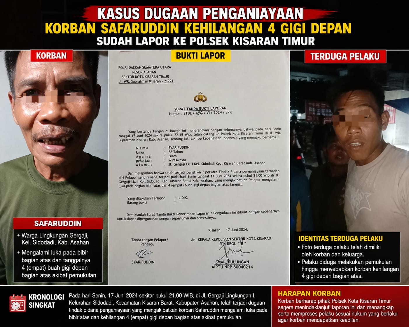 4 Gigi Copot Akibat Dianiaya, Korban Safaruddin Pertanyakan Kepastian Hukum